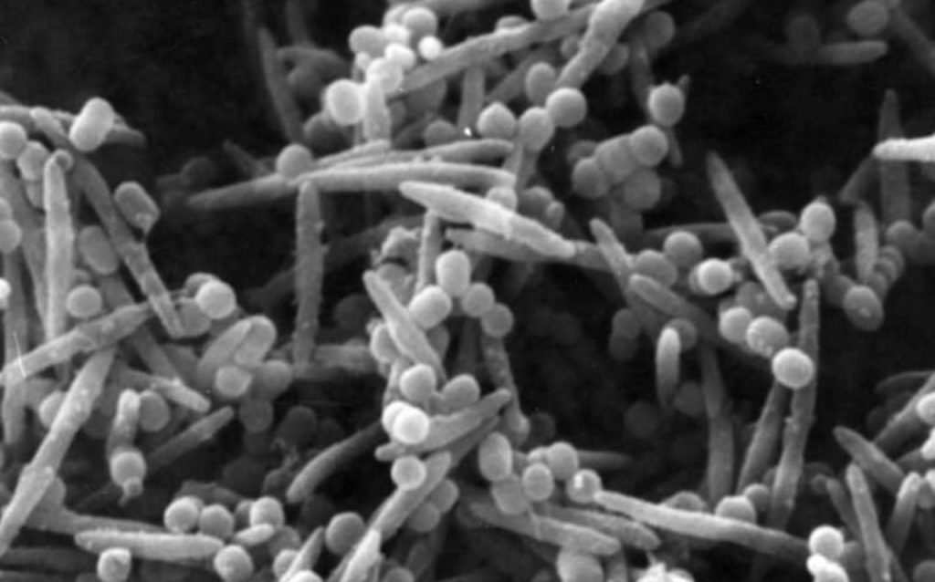 Know your dog’s gut bacteria: Fusobacterium