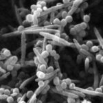 Know your dog’s gut bacteria: Fusobacterium